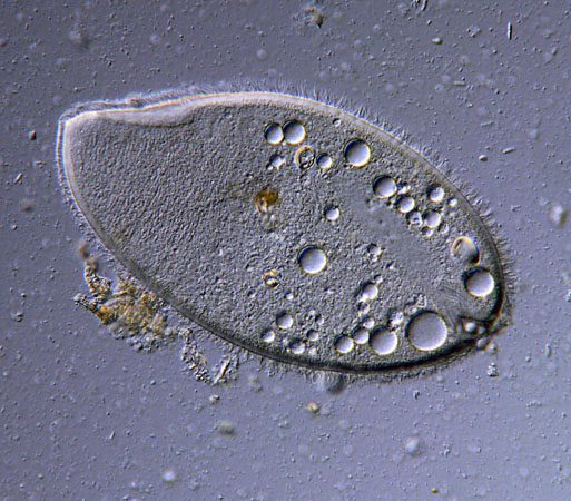 microscopia de contraste interferencial