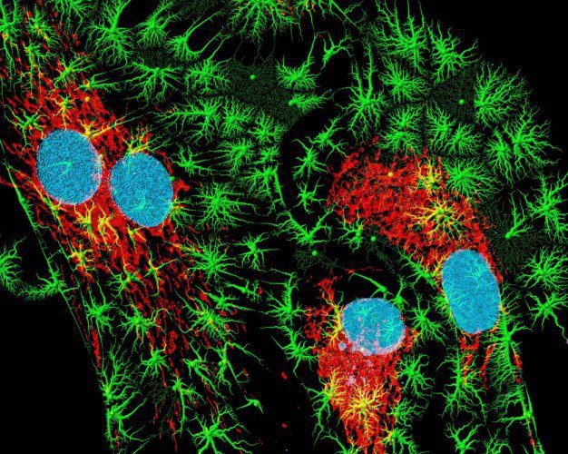 microscopia de fluorescência